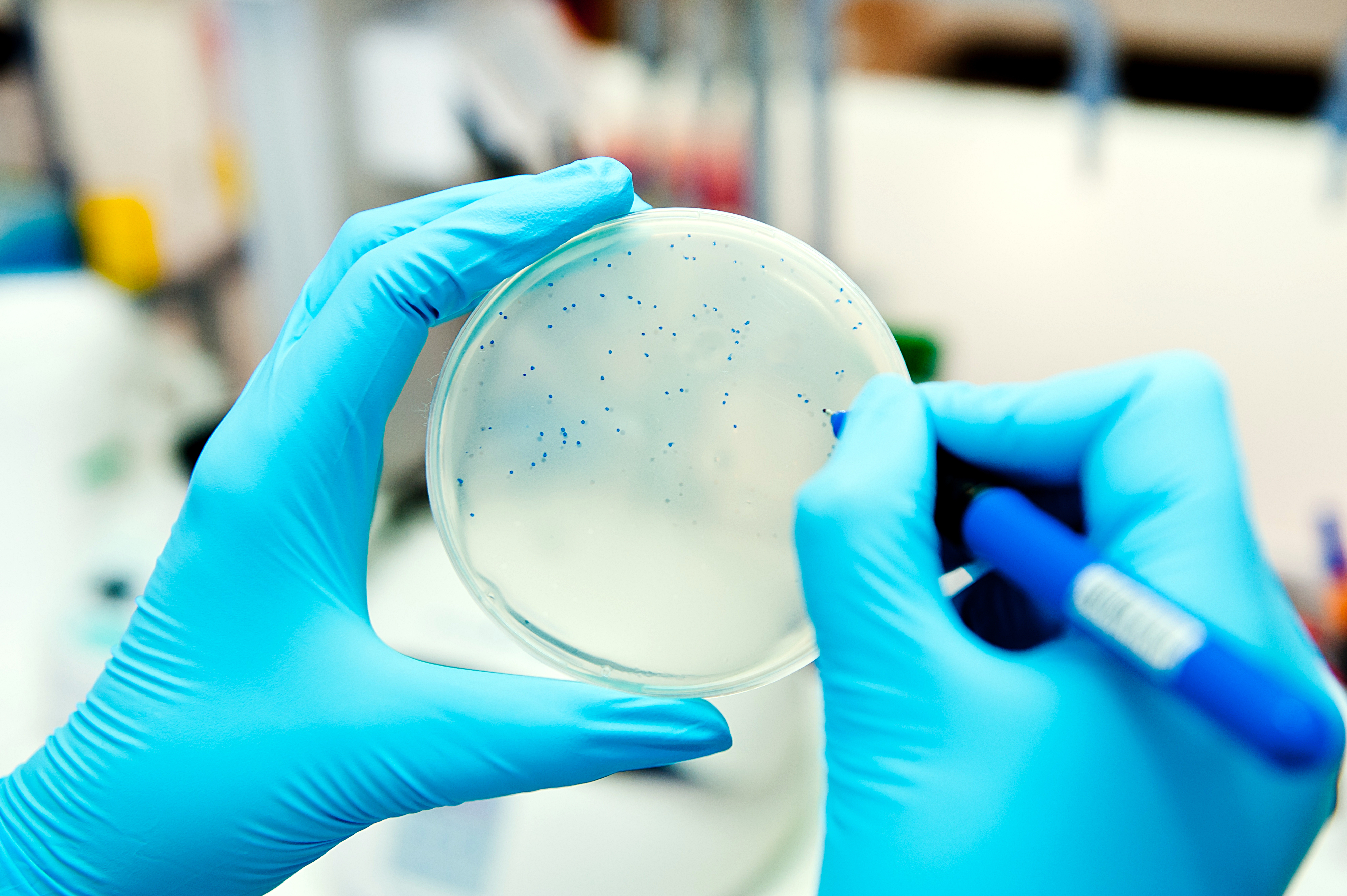 Medical-Grade Phage Solution Scientist counting phage plaques